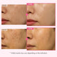 Crema Coreana Aclarante — Elimina Manchas y Marcas de Acné