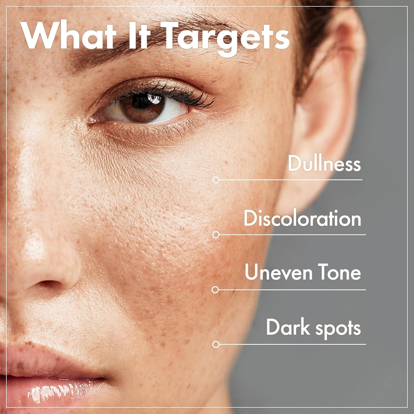Crema Coreana Aclarante — Elimina Manchas y Marcas de Acné